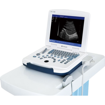 ultra-som médico para gravidez e preço de ultra-som modo B